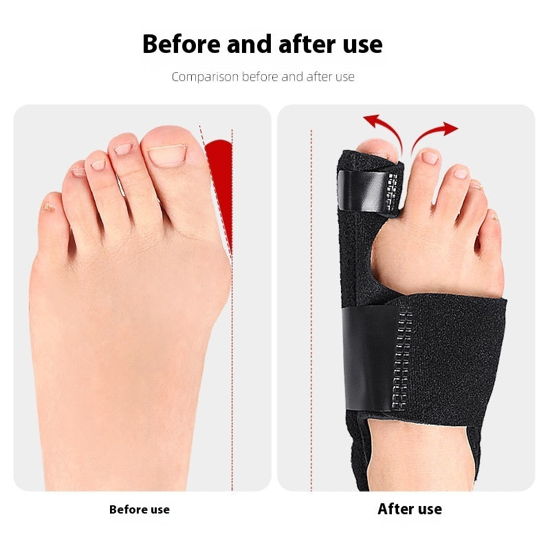Thumb Hair Curler Hallux Valgus Toe Separator